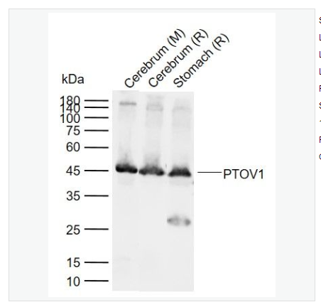 Anti-PTOV1 antibody   -前列腺肿瘤高表达蛋白1抗体