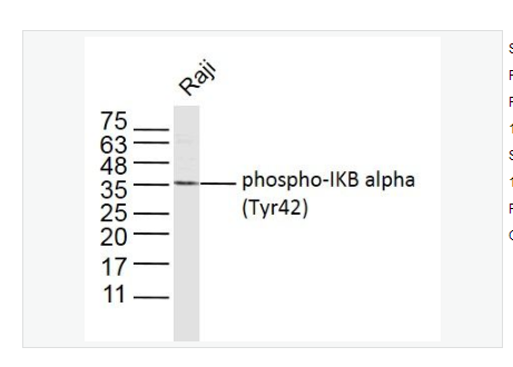 Anti-phospho-IKB alpha antibody   -磷酸化IKB α抗体