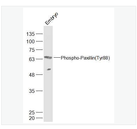 Anti-Phospho-Paxillin antibody   -磷酸化桩蛋白Paxillin抗体