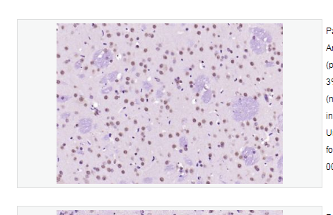 Anti-SOX9 antibody   -转录因子SOX9蛋白抗体