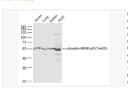 Anti-phospho-NFKB p65 antibody   -磷酸化细胞核因子抗体