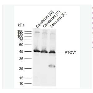 Anti-PTOV1 antibody   -前列腺肿瘤高表达蛋白1抗体