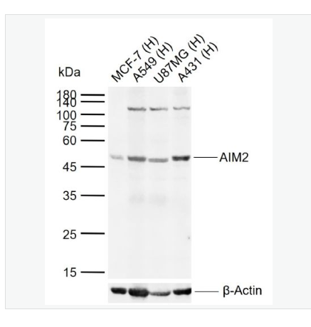 Anti-AIM2 antibody   -干扰素诱导蛋白AIM2抗体