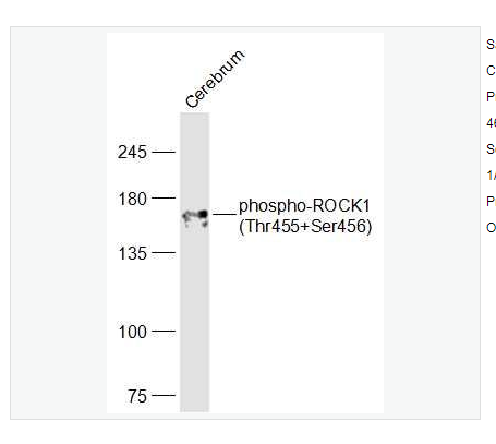 Anti-phospho-ROCK1 antibody   -磷酸化Rho相关蛋白激酶1抗体