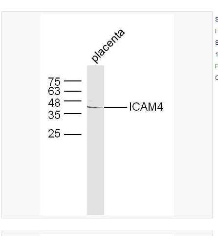 Anti-ICAM4antibody   -细胞间粘附分子4抗体