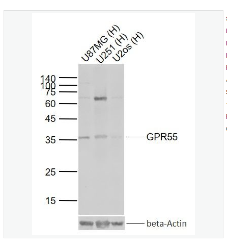 Anti-GPR55 antibody   -蛋白偶联受体55抗体