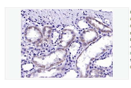 Anti-ALAS1 antibody   -5-氨基乙酰丙酸合酶1抗体