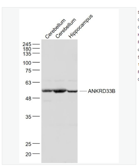 Anti-ANKRD33B antibody  -锚蛋白重复结构域蛋白33B抗体