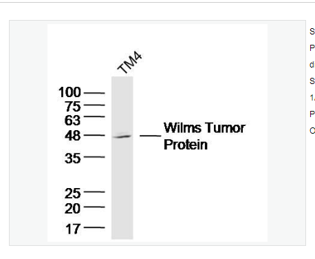 Anti-WT1 antibody  -肾母细胞瘤蛋白抗体