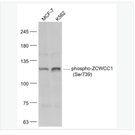 Anti-phospho-ZCWCC1 antibody  -磷酸化ZCWCC1抗体