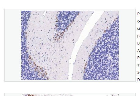 Anti-CACNA1G + CACNA1H antibody  -电压依赖性钙通道CACNA1G+CACNA1H抗体