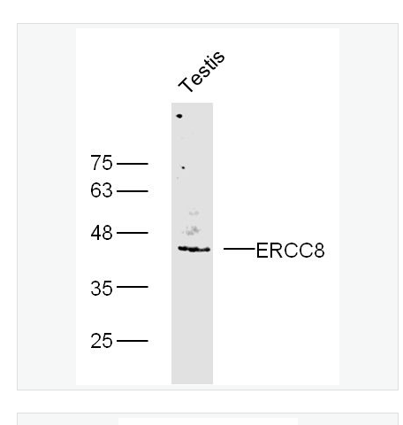 Anti-ERCC8 antibody  -科凯恩氏综合症相关蛋白/早衰蛋白CSA抗体