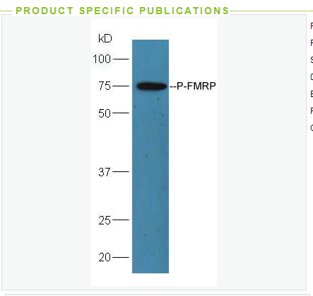 Anti-phospho-FMRP  antibody  -磷酸化脆性X综合征相关蛋白AFF1抗体