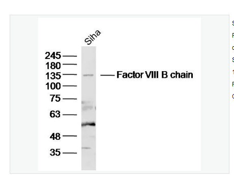 Anti-Factor VIII B chain  antibody  -凝血因子8/第八凝血因子/第八因子相关抗原抗体