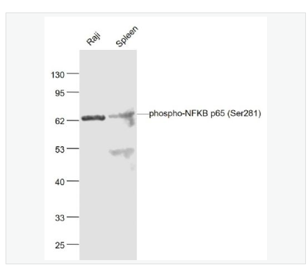 Anti-phospho-NFKB p65 antibody  -磷酸化细胞核因子抗体