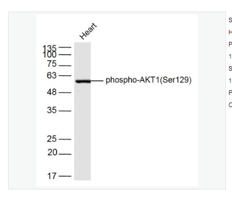 Anti-phospho-AKT1antibody  -磷酸化蛋白激酶B抗体