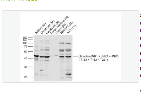 Anti-phospho-JNK1 + JNK2 + JNK3antibody  -磷酸化氨基末端激酶1/2/3抗体