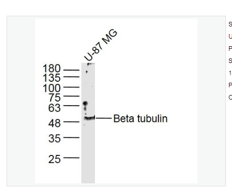 Anti-Beta tubulinantibody  -微管蛋白β tubulin/Tubulin β抗体