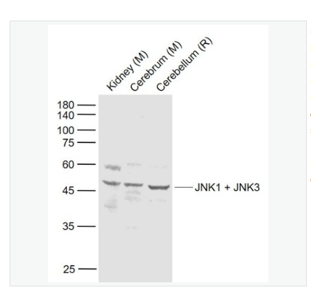 Anti-JNK1 + JNK3 antibody  -氨基末端激酶1/3抗体