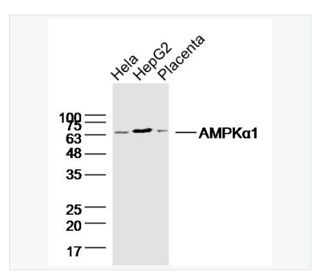 Anti-AMPK alpha-1  antibody  -腺苷单磷酸活化蛋白激酶α1/AMPK α 1单克隆抗体