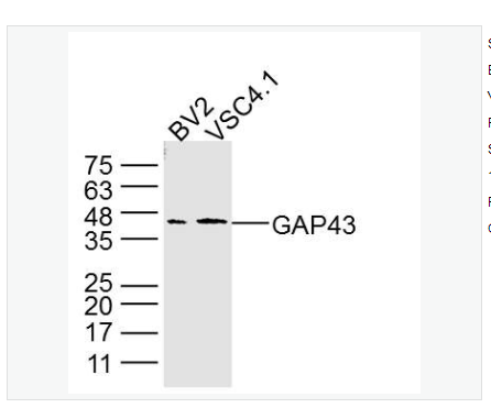 Anti-GAP43  antibody  -神经生长相关蛋白43单克隆抗体