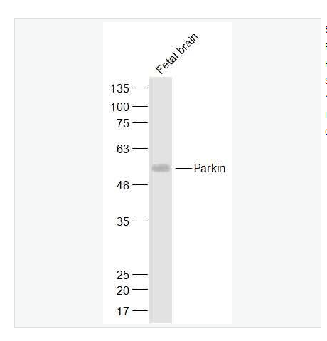 Anti-Parkin antibody  -帕金蛋白抗体