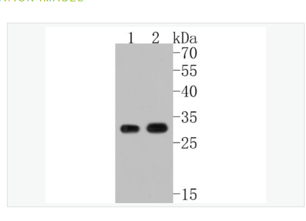Anti-CDK1 antibody  -周期素依赖性激酶1重组兔单克隆抗体