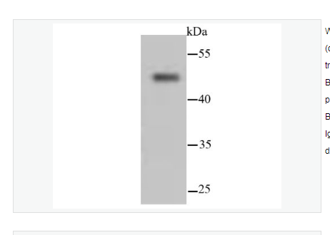 Anti-Cytokeratin 13 antibody  -细胞角蛋白13重组兔单克隆抗体