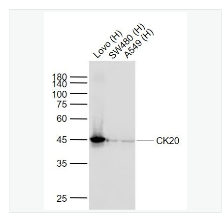 Anti-CK2 antibody  -细胞角蛋白20重组兔单克隆抗体