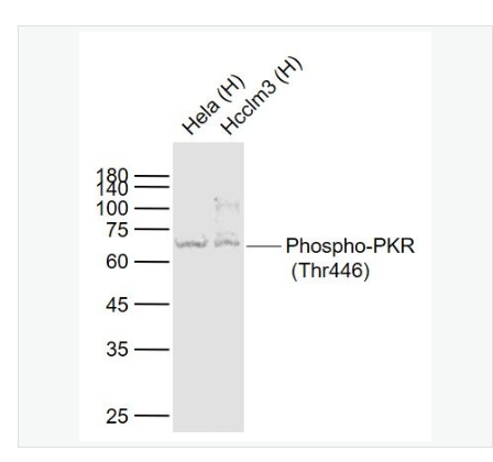 Anti-Phospho-PKR antibody  -磷酸化干扰素诱导的双链RNA活化蛋白激酶重组兔单克隆抗体