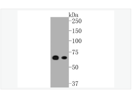 Anti-MEKK3 antibody  -MAPK/ERK激酶3重组兔单克隆抗体