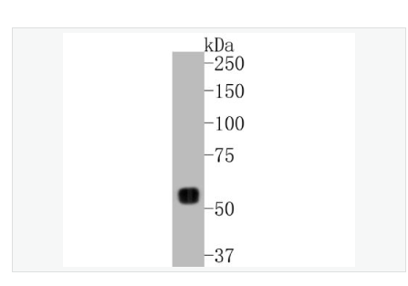 Anti-MMP14 antibody  -基质金属蛋白酶-14重组兔单克隆抗体