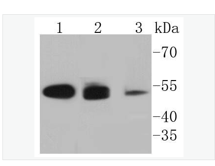 Anti-Cytokeratin 8 antibody  -细胞角蛋白8重组兔单克隆抗体