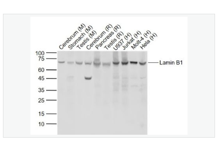 Anti-Lamin B1 antibody  -核纤层蛋白B重组兔单克隆抗体