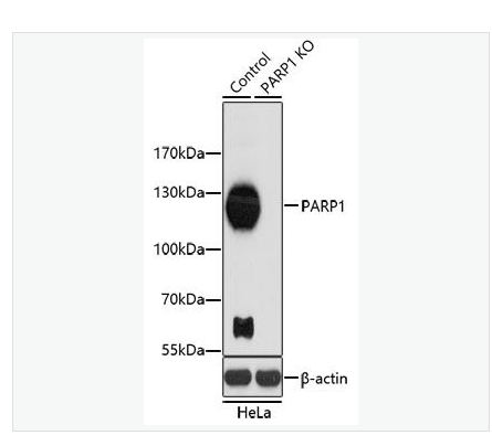 Anti-PARP1  antibody  -多腺苷二磷酸多聚酶抗体