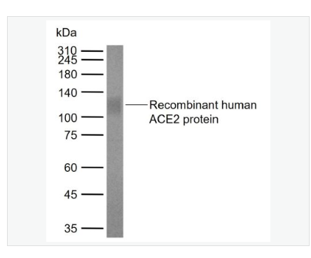 Anti-ACE2  antibody  -血管紧张素转换酶2单克隆抗体