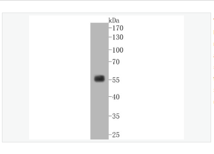 Anti-SGK1 antibody  -糖皮质激素调节激酶1重组兔单克隆抗体