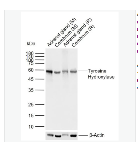 Anti-Tyrosine Hydroxylase antibody  -酪氨酸羟化酶兔单克隆抗体