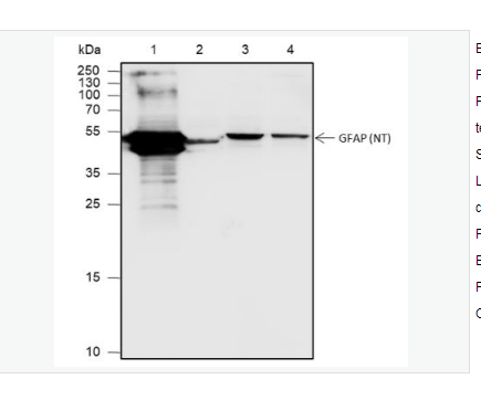 Anti-GFAP antibody  -胶质纤维酸性蛋白重组兔单克隆抗体