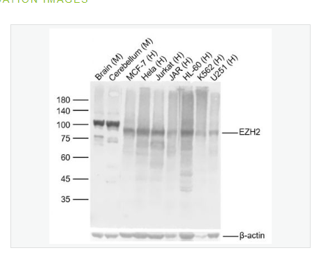 Anti-EZH2  antibody  -抑癌蛋白EZH2重组兔单克隆抗体