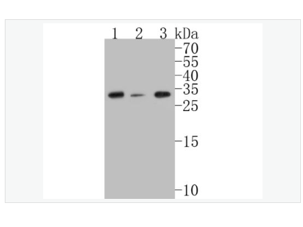 Anti-CHMP2B antibody  -染色质修饰蛋白2B重组兔单克隆抗体