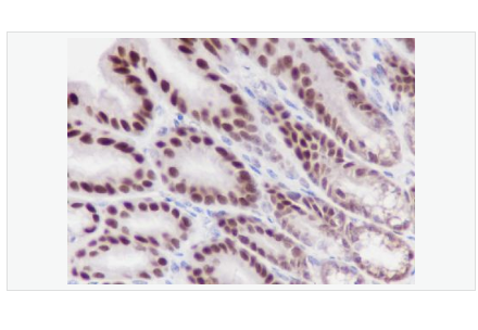 Anti-XRCC5/Ku80 antibody  -DNA修复酶Ku-80重组兔单克隆抗体