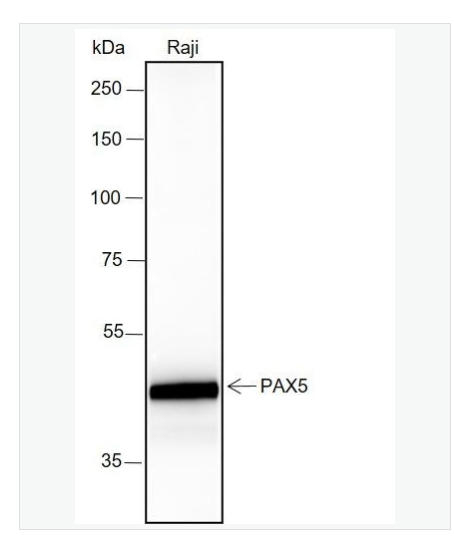 Anti-PAX5 antibody  -配对盒基因5重组兔单克隆抗体