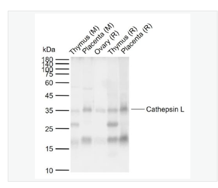 Anti-Cathepsin L  antibody  -组织蛋白酶L抗体