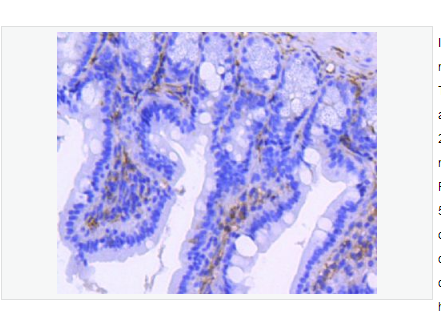 Anti-ITGB3 antibody  -整合素β3/CD61重组兔单克隆抗体