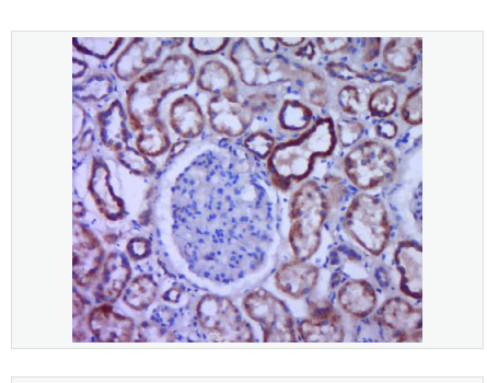 Anti-ACE  antibody  -血管紧张素转换酶ACE1抗体