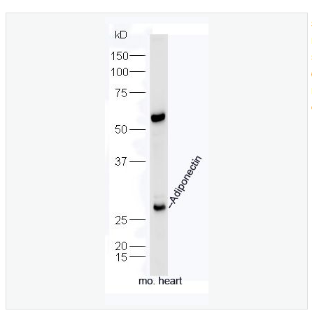 Anti-Adiponectin-NTP  antibody  -脂联素抗体