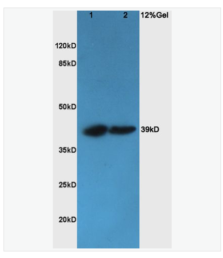 Anti-CHI3L1   antibody  -软骨糖蛋白39抗体