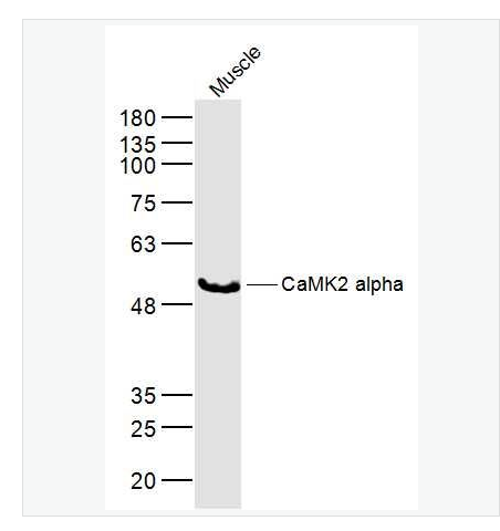 Anti-CaMK2 alpha antibody  -钙/钙调素依赖蛋白激酶2α抗体