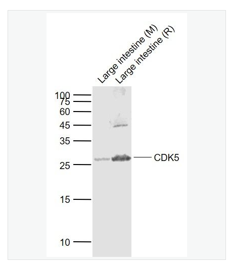 Anti-CDK5 antibody  -周期素依赖性激酶5抗体